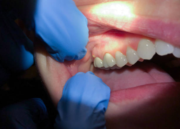 Best Emergency Gum Pain Relief  in , VA